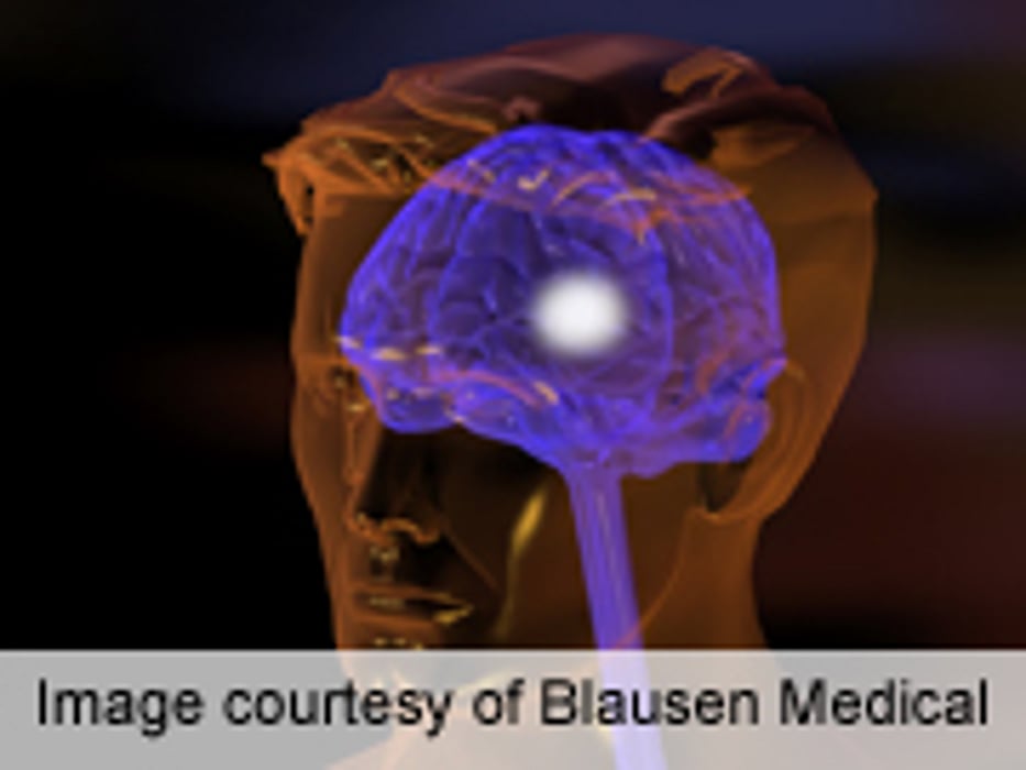 AES: Psychosocial Benefits Seen for Resective Epilepsy Surgery