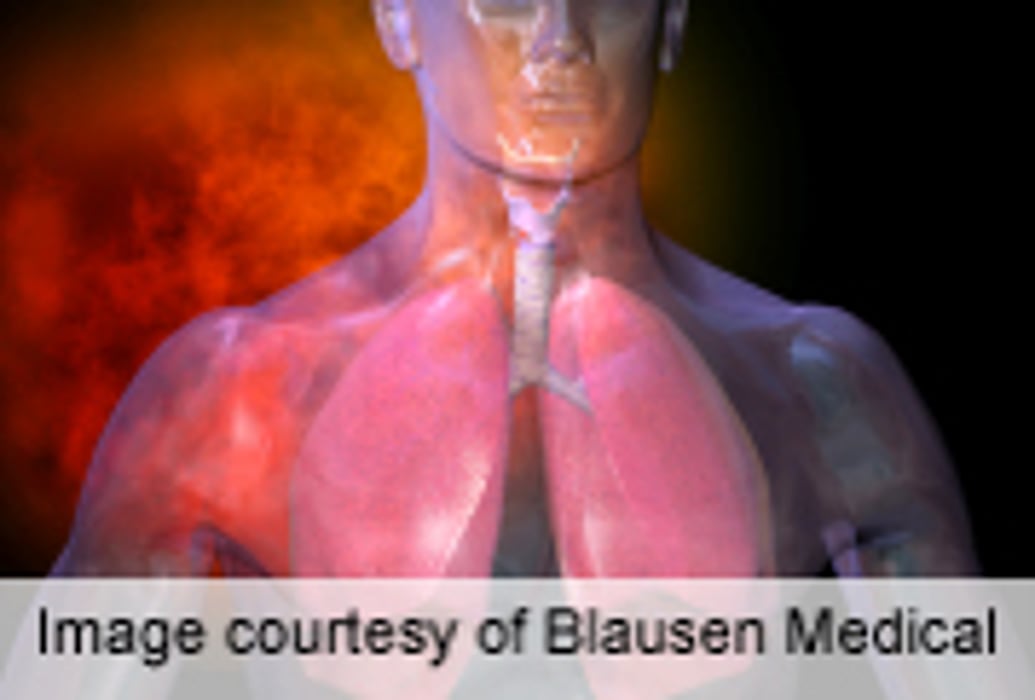 Childhood Abuse Tied to Adult-Onset Asthma in Black Women