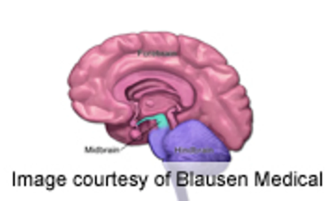 Electrical Brain Stimulation Plus Drug Fights Depression: Study