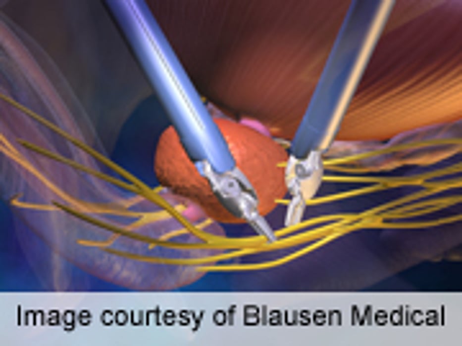 Targeted Beats Random Biopsy for Prostate Cancer Detection