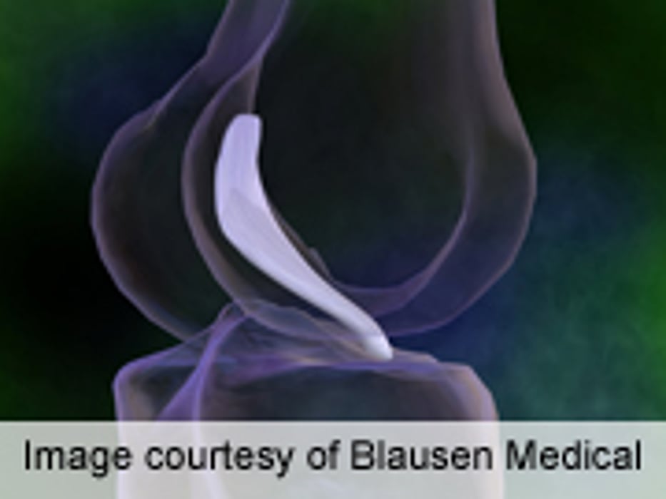 Anterior Cruciate Ligament Surgery Not Needed for All Skiers
