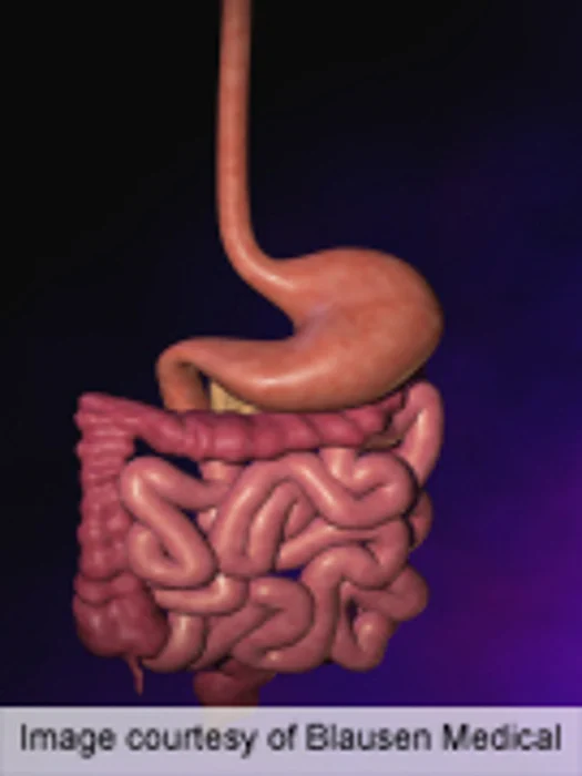 Magnetic Implant May Ease Chronic Acid Reflux