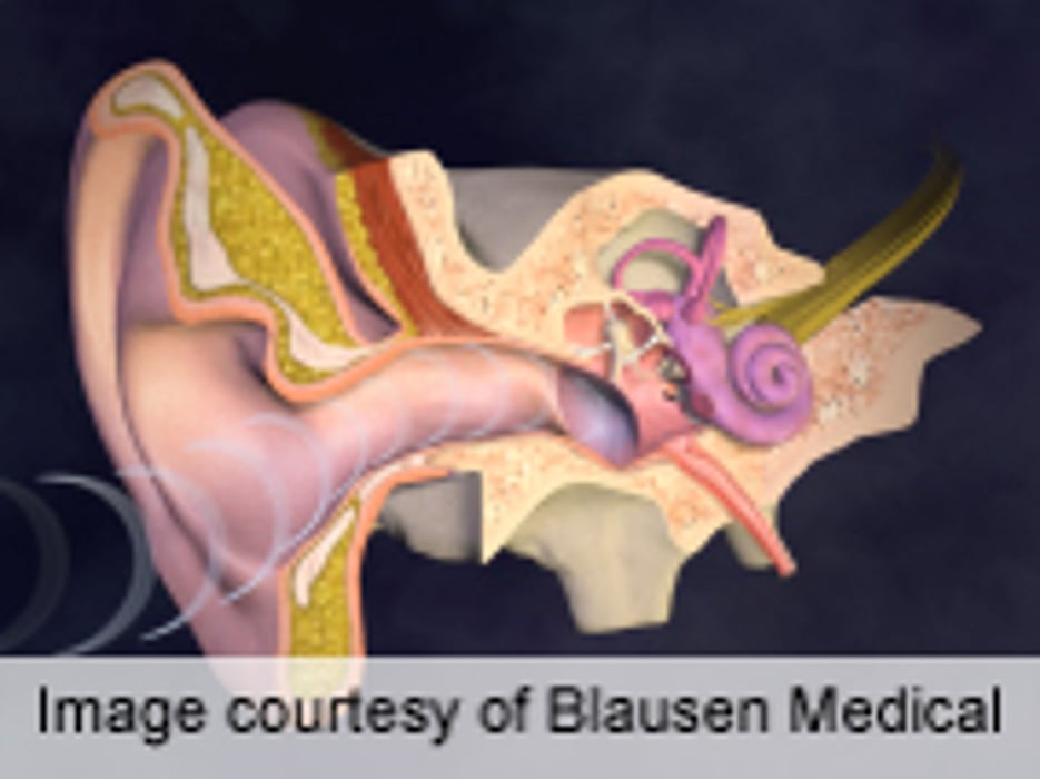 Post-Op Tympanostomy Tube Obstruction Seen in 1 in 10