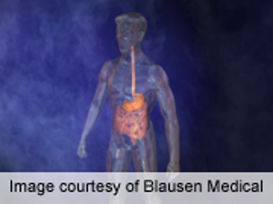 High-Fat Diet Impairs Satiation Signaling in Obese-Prone