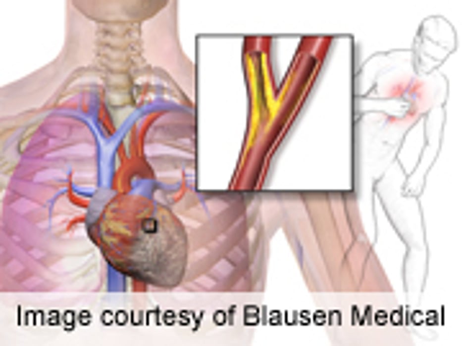 angina diabetes