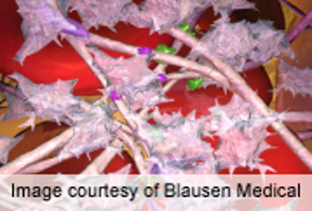 Inhibitor Development Risk Similar for Factor VIII Products