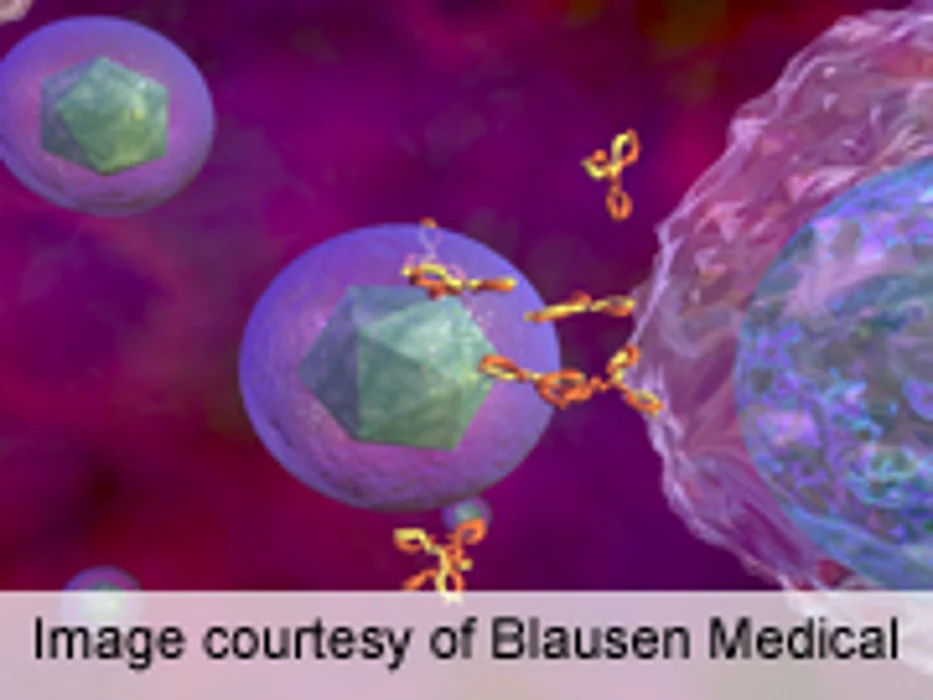 Canadian Pediatric Lupus Severity Varies With Ethnicity