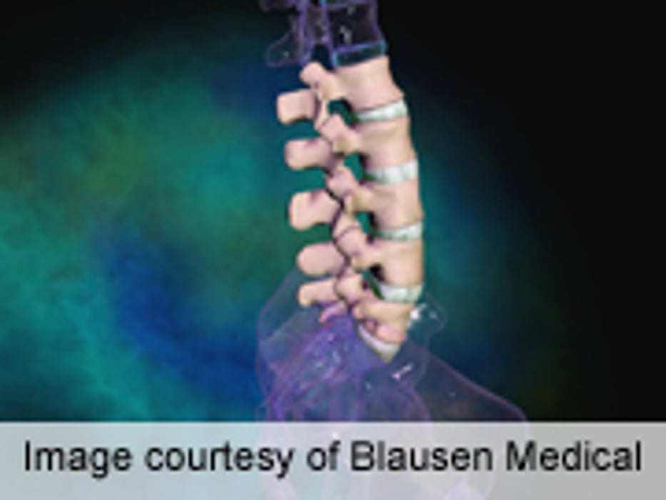 Patient Satisfaction a Poor Proxy After Spine Surgery