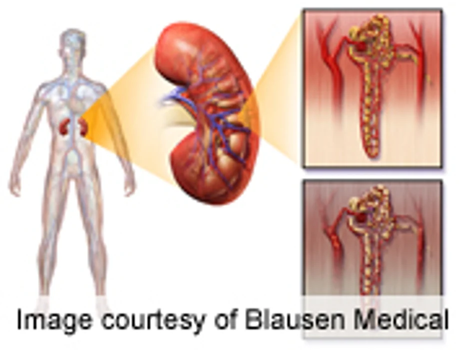 Creatinine Excretion Rate Linked to Higher Mortality in T2DM