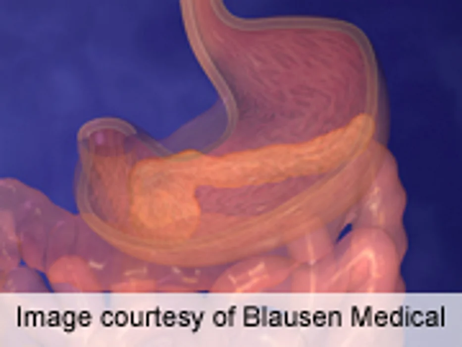 Cancer Prevalence Higher With Long Duration of Diabetes