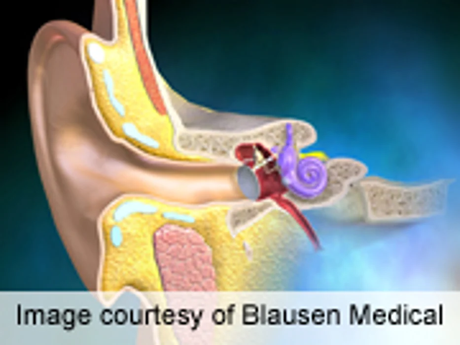 Hearing Loss Linked to Cognitive Impairment in Elderly