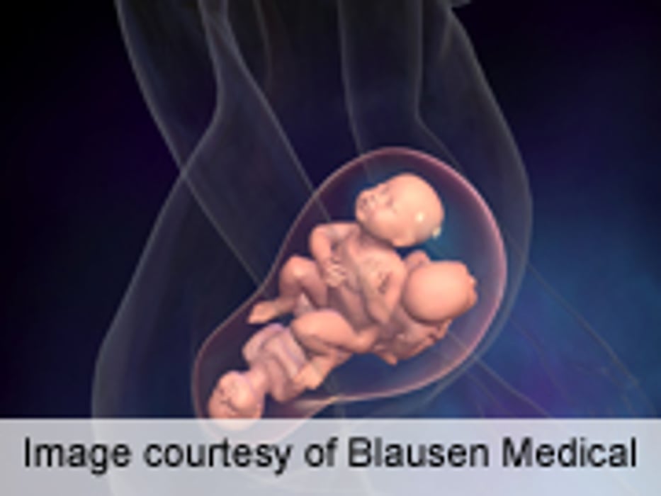 Study Discusses Ethics of Multifetal Pregnancy Reduction
