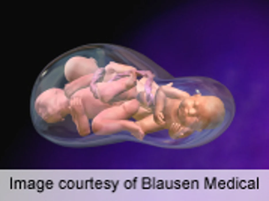 Ob/Gyn Group Urges Docs to Help Prevent 'Octomom'-Type Multiple Births