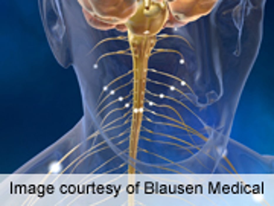 Early Signs That High-Calorie Diet May Help With Lou Gehrig's Disease