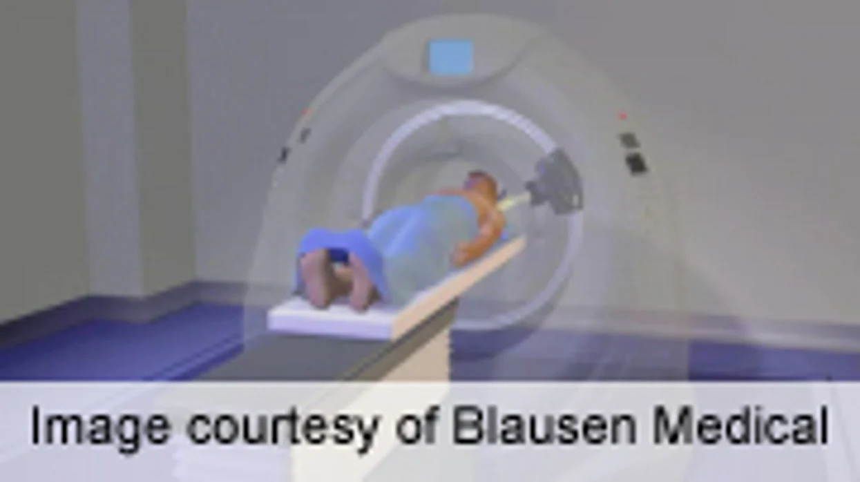ASTRO: Few PCPs Order Low-Dose CT for Lung CA Screening