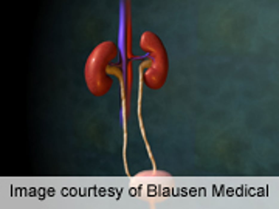 Thiazide Prophylaxis for Kidney Stones Doesn't Increase DM Risk