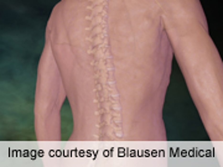 Studies of Nonoperative Tx for Discogenic Back Pain Lacking