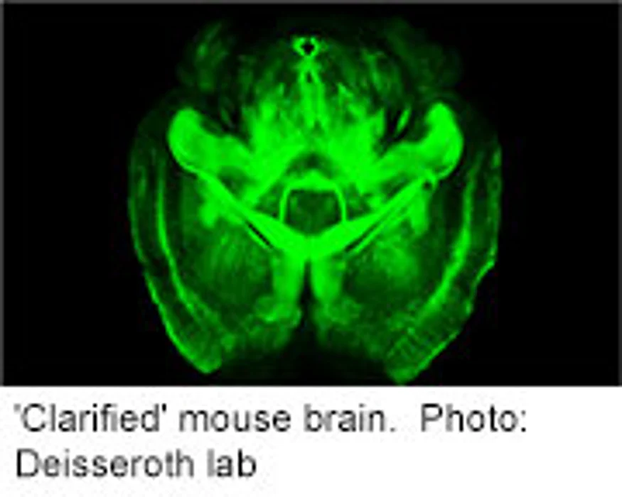 'Transparent' Mouse Brain Could Shed Light on Human Brain Health