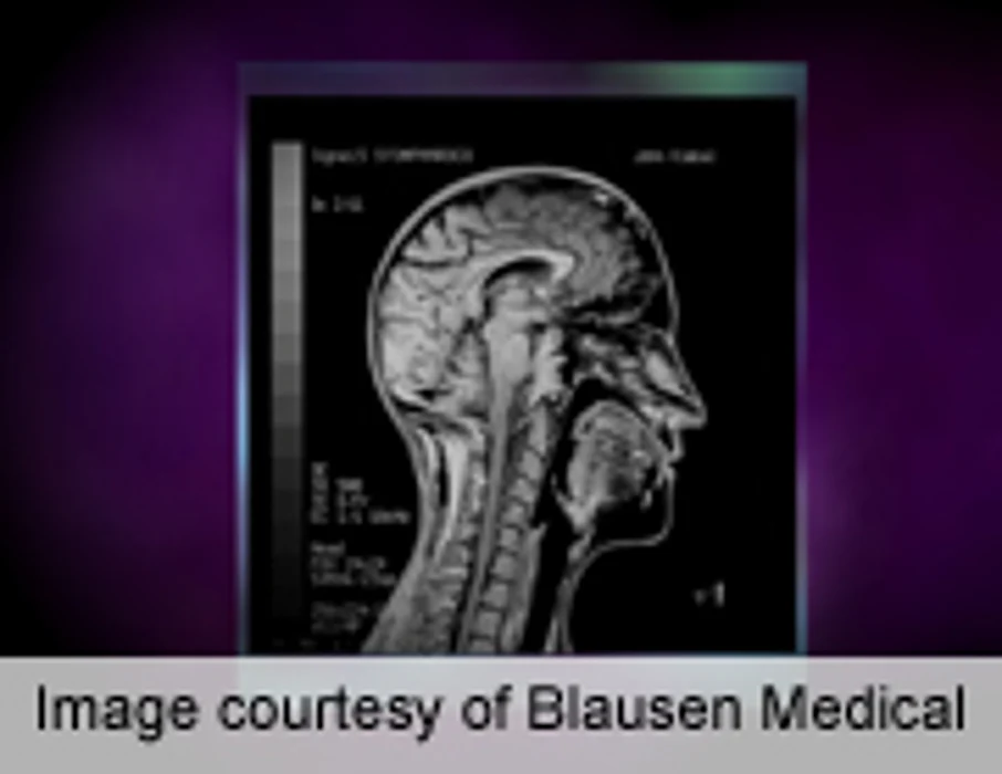 Functional MRI Can Be Used to Assess Physical Pain