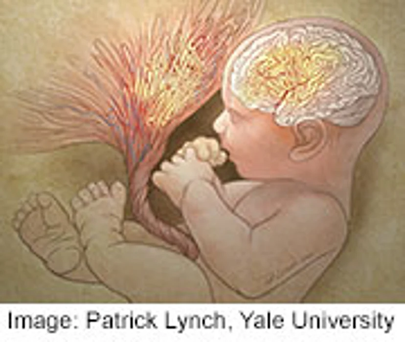 Newborn's Placenta May Predict Autism Risk, Study Suggests