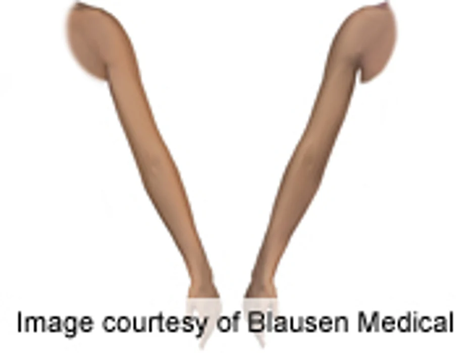 2012 Saw Major Increase in 'Arm Lift' Cosmetic Procedures