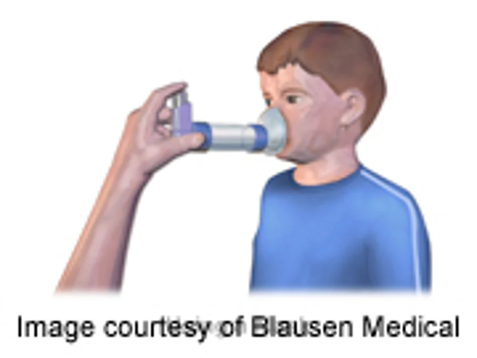 Allergies: As American as Apple Pie?