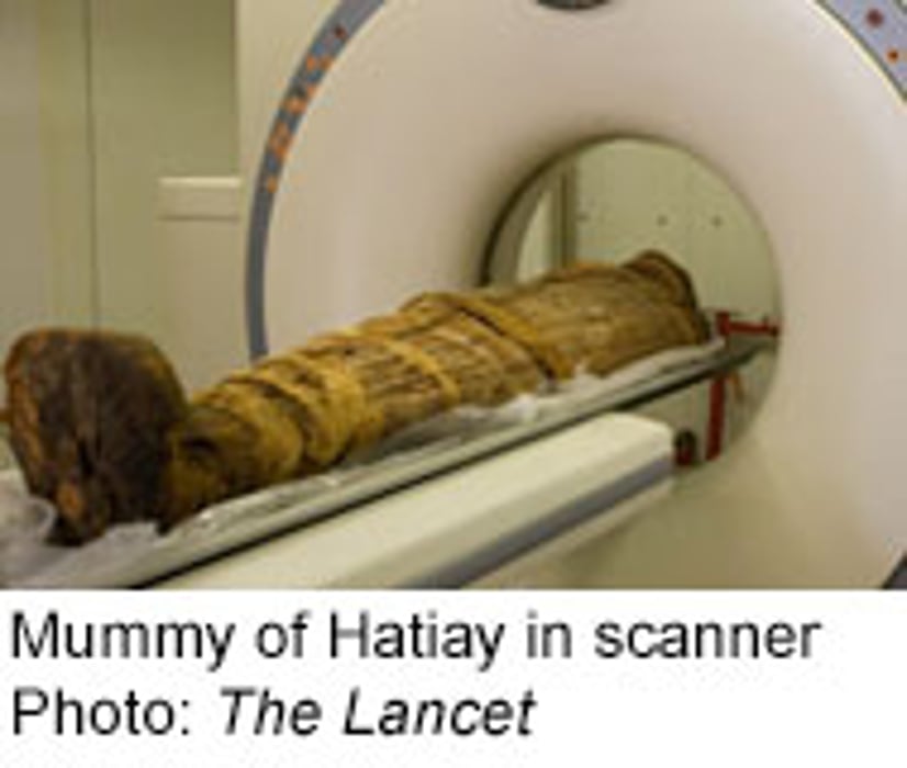 Was Heart Disease the Mummies' Real Curse?