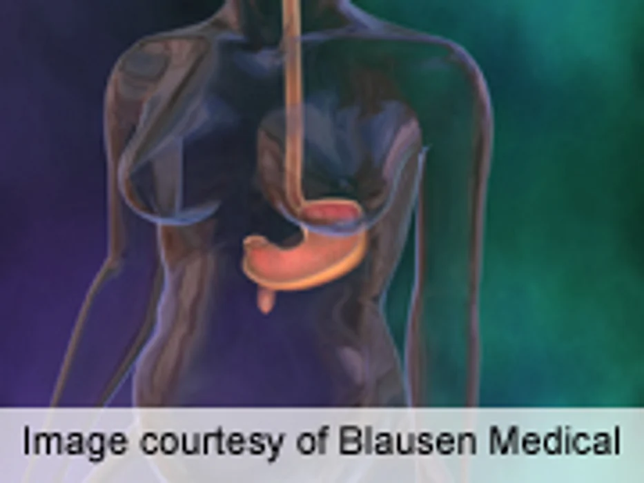 Triglycerides Significantly Elevated in Women With GDM