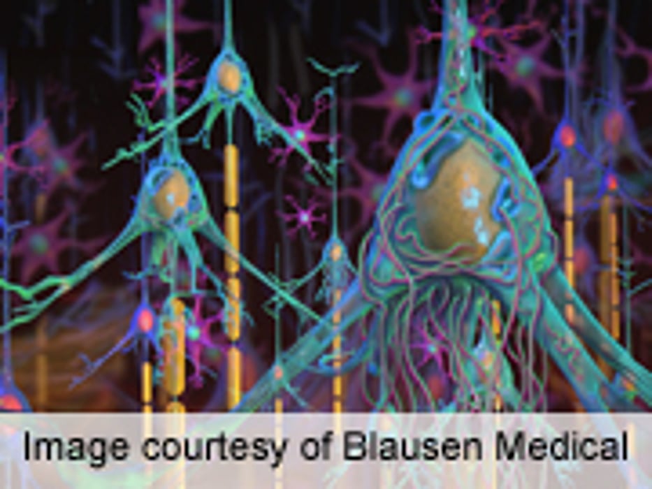 CSF Biomarkers ID Alzheimer's Independent of APOE Genotype