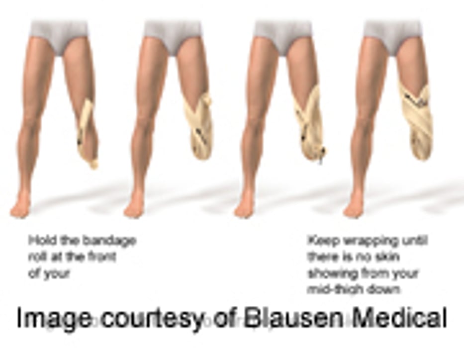 Race Influences Lower Extremity Ischemia Treatment