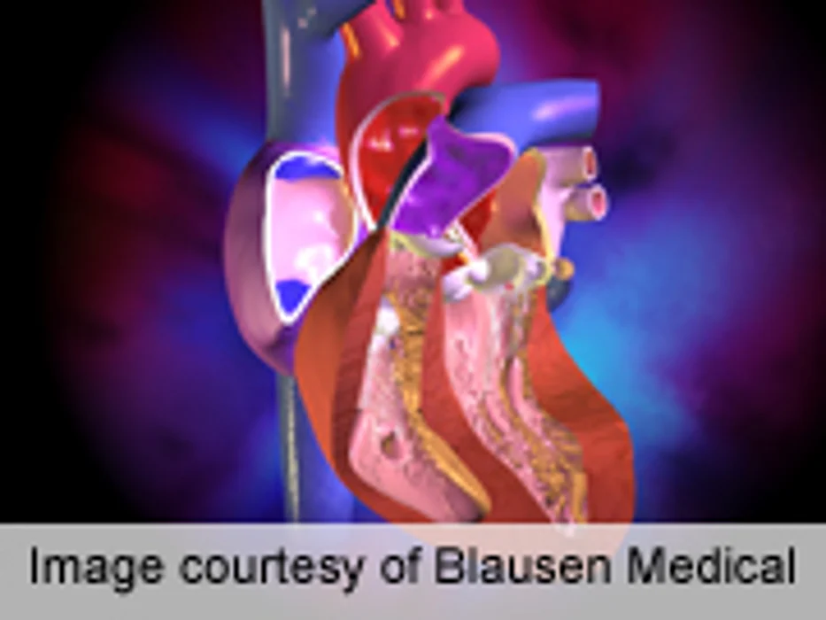 AHA Releases Statement on Fetal Cardiac Disease