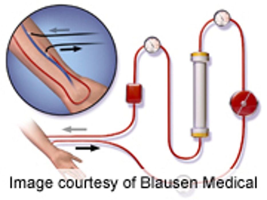 Patient-Doctor Contact Betters Hemodialysis Outcomes