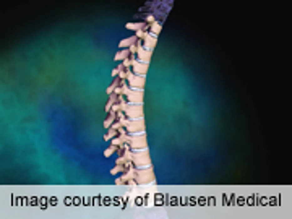 Low Oxygen Exposure May Aid Walking With Spinal Injury