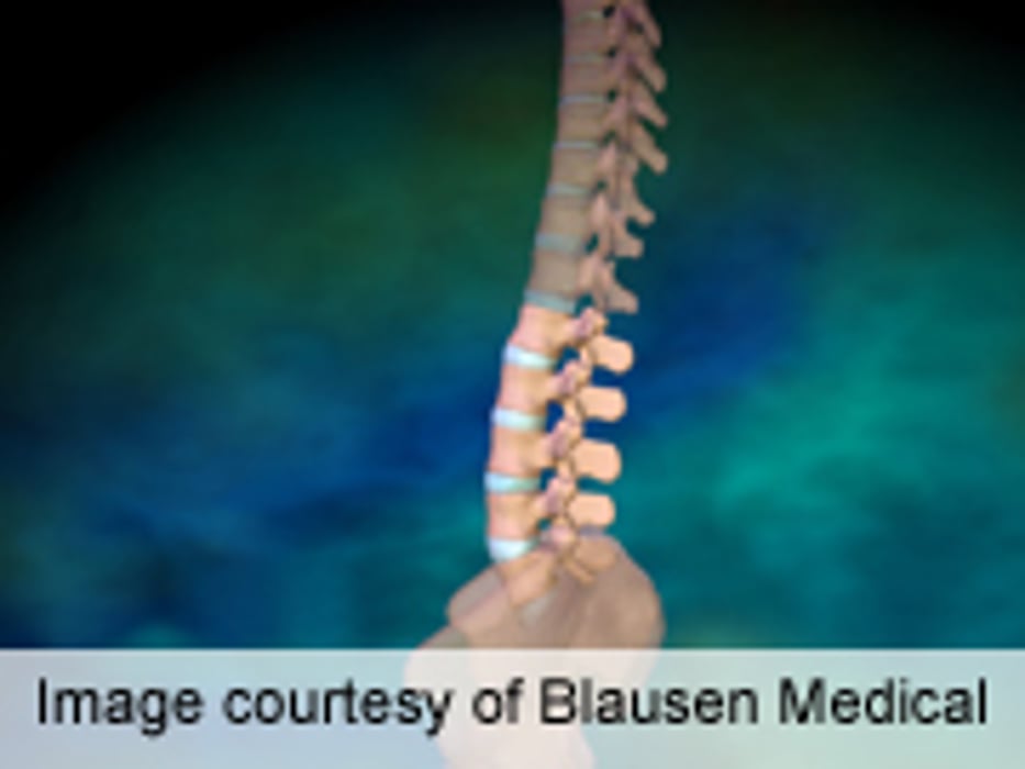 Spine Surgeons Vary Considerably in Imaging Practices