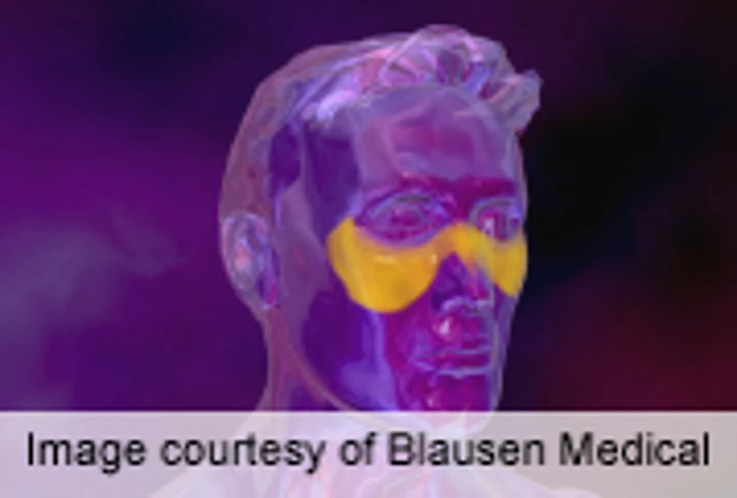 Kidney Involvement, High Anti-dsDNA Predict Lupus Flares