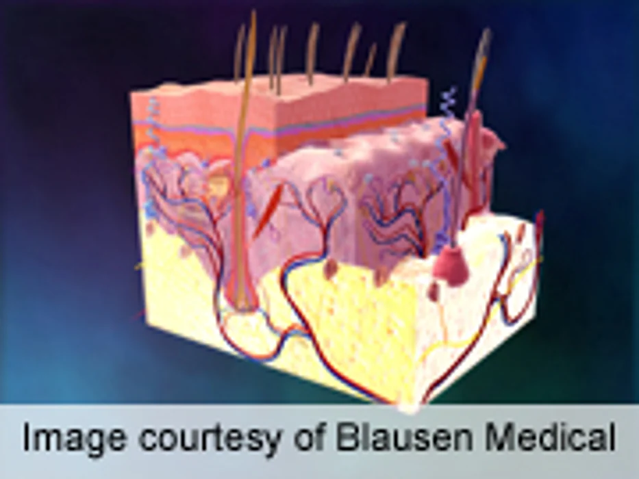 Skin Cancer Tx Mostly Surgical, Regardless of Life Expectancy