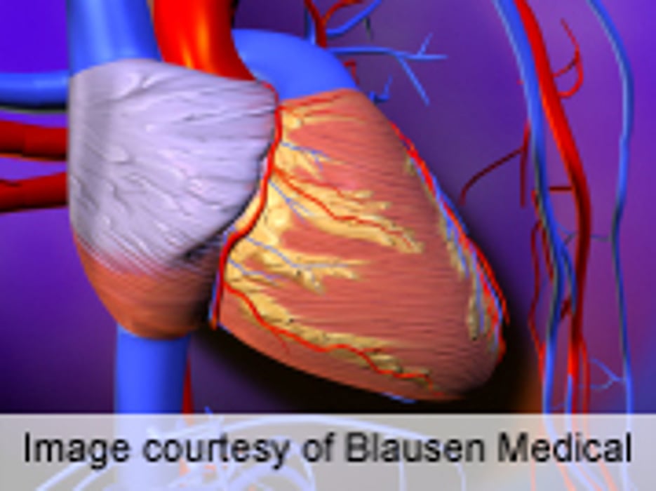 Post-PCI Deaths Increasingly From Noncardiac Causes
