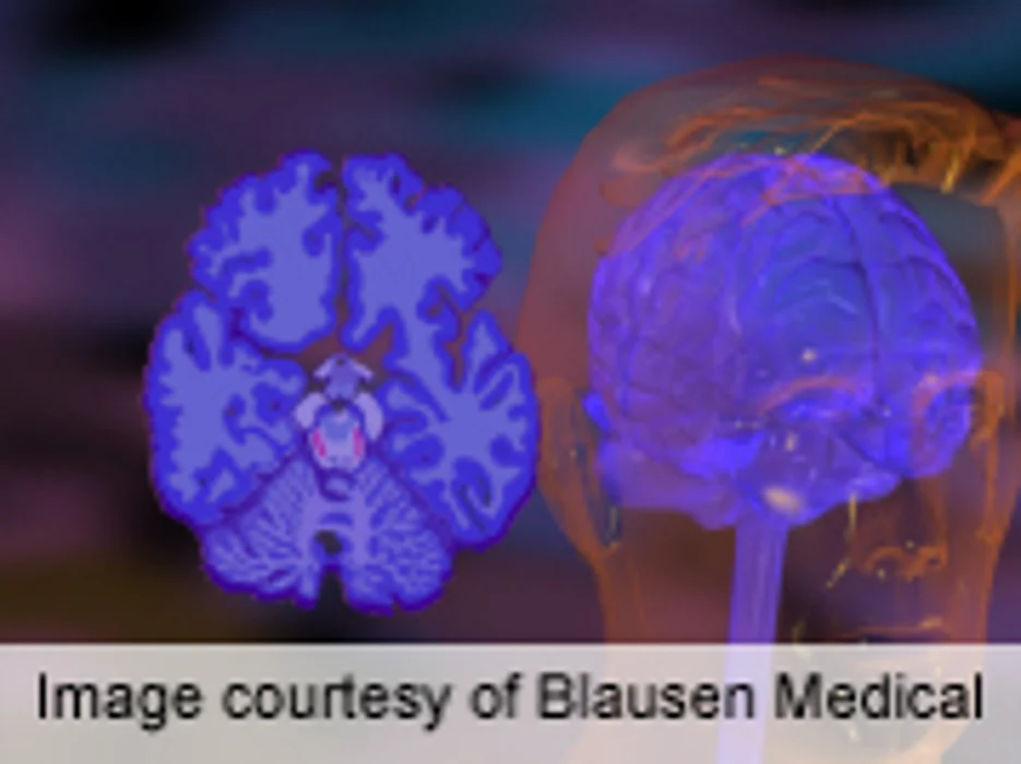 Typical ADHD Care Leaves Room for Improvement