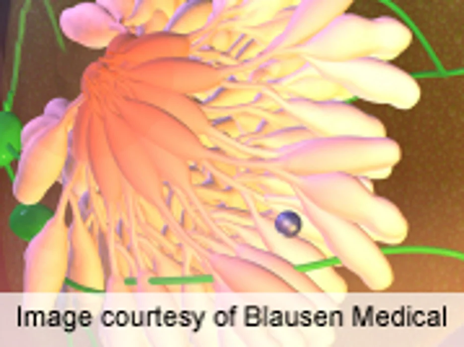 Combination Imaging Ups Differentiation of Breast Tumors