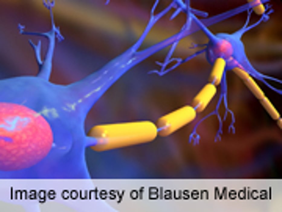 MS Remission Sustained Three Years Post-Stem Cell Transplant