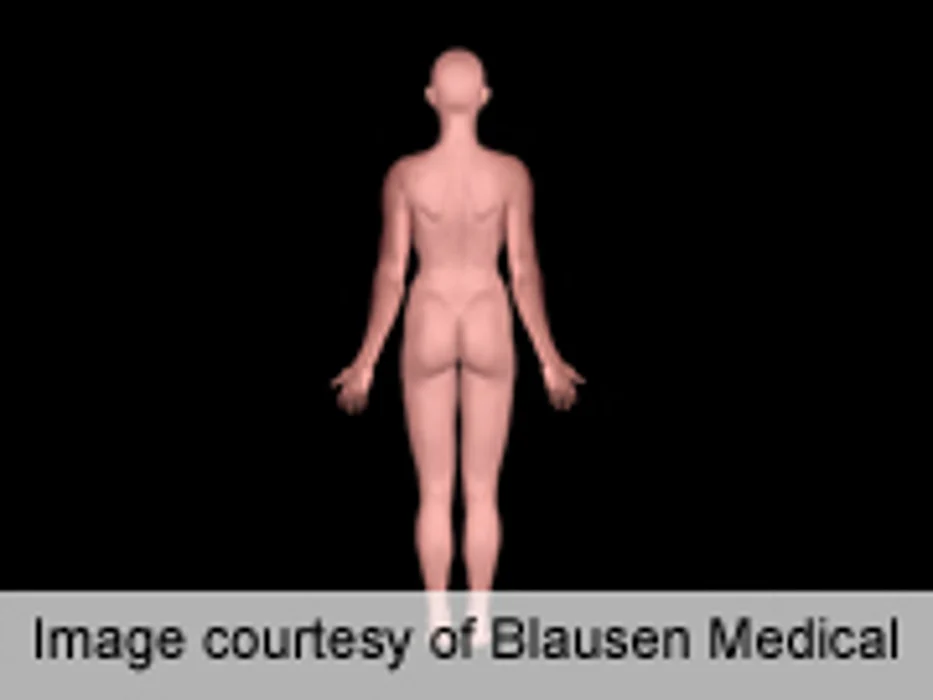 ASPS: High Patient Satisfaction With Autologous Gluteoplasty
