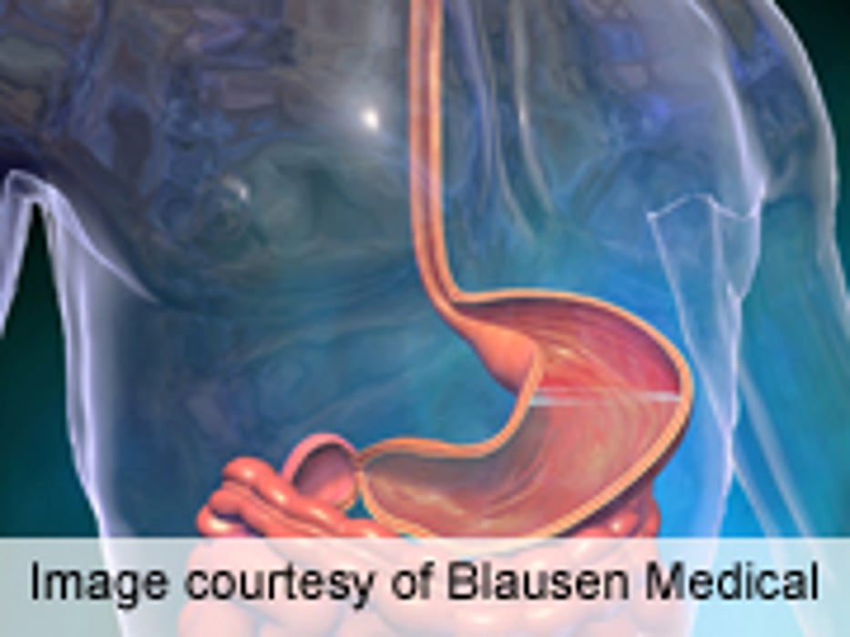 Gastric, Esophageal Cancer Risk Linked to Teen Overweight