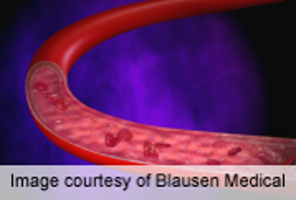 Consumption of Probiotics May Lower Blood Pressure