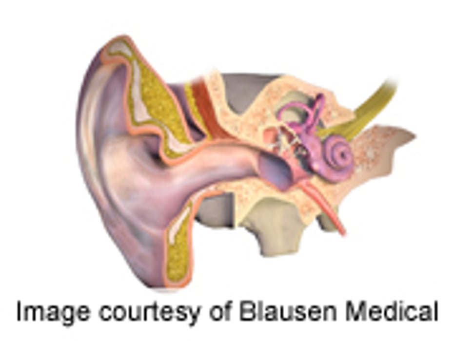 Tinnitus-Linked Symptoms Improved With D-Cycloserine