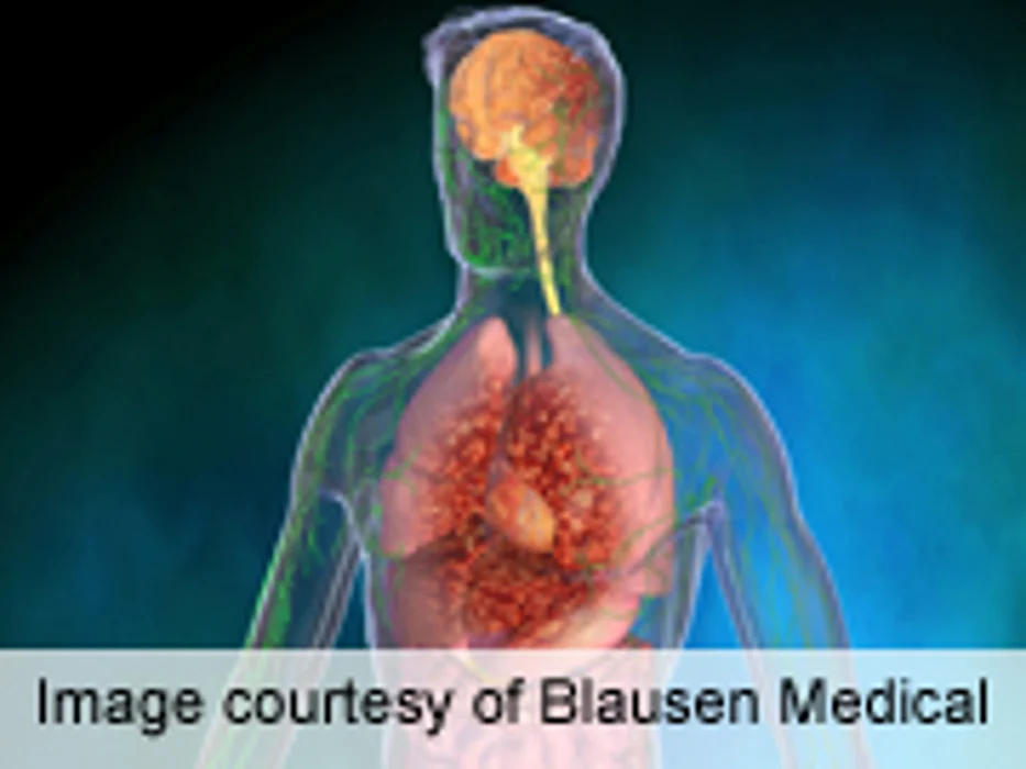Central Adiposity Linked to Risk of Esophageal Cancer