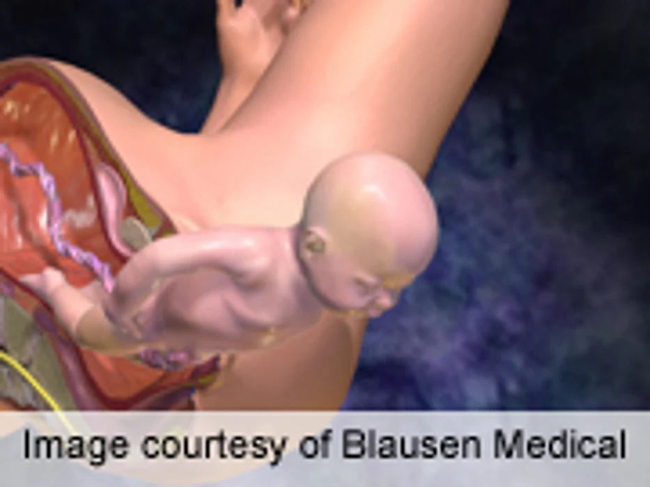 Human Error Most Often Responsible for Birth Asphyxia