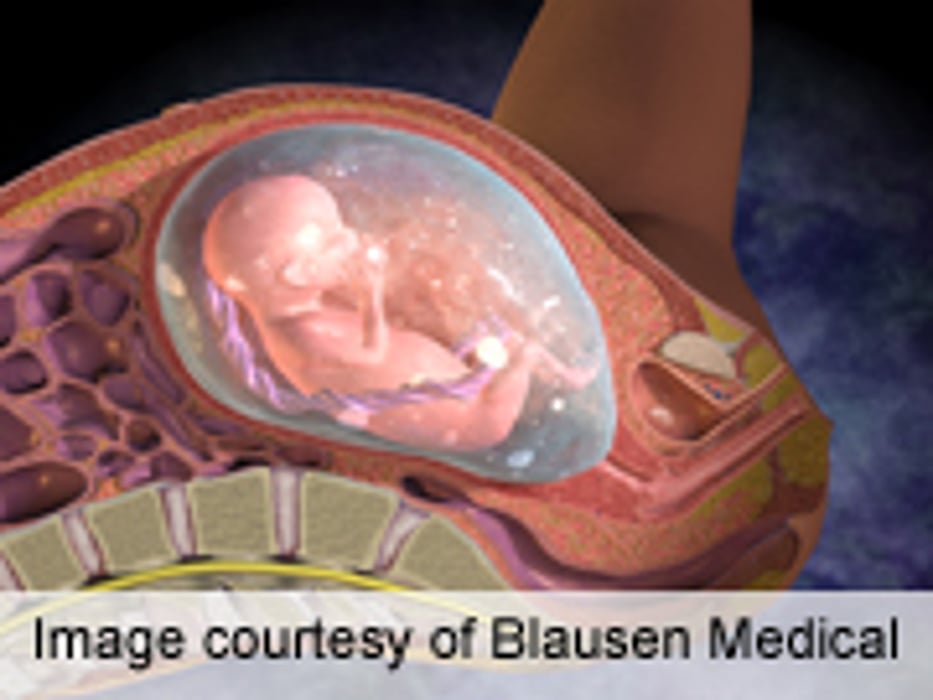 Universal Transvaginal Ultrasound Found Cost-Effective