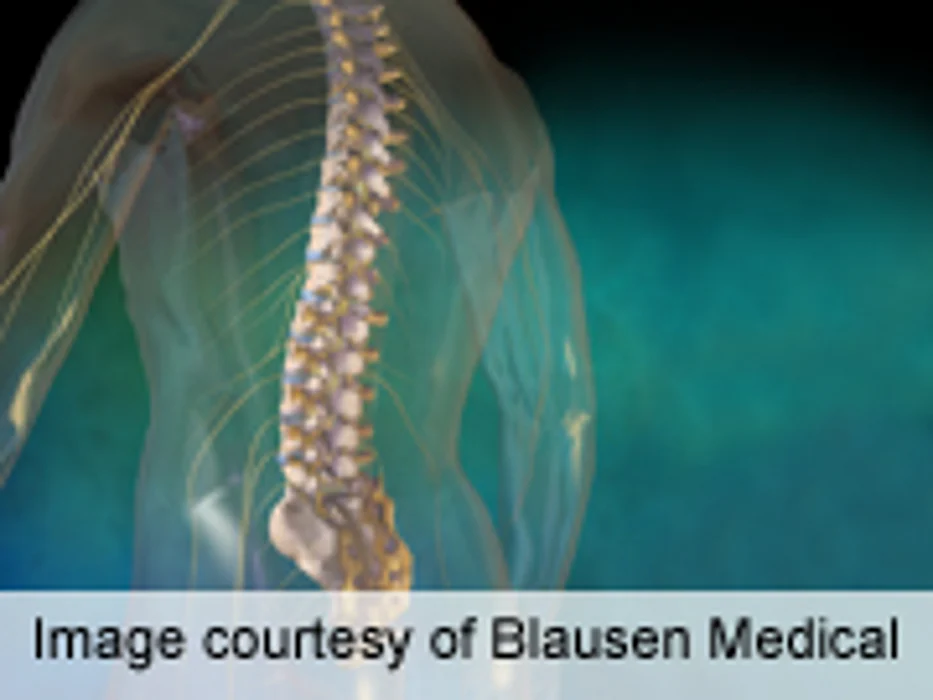 Professional Fees Represent Small Part of Laminectomy Cost