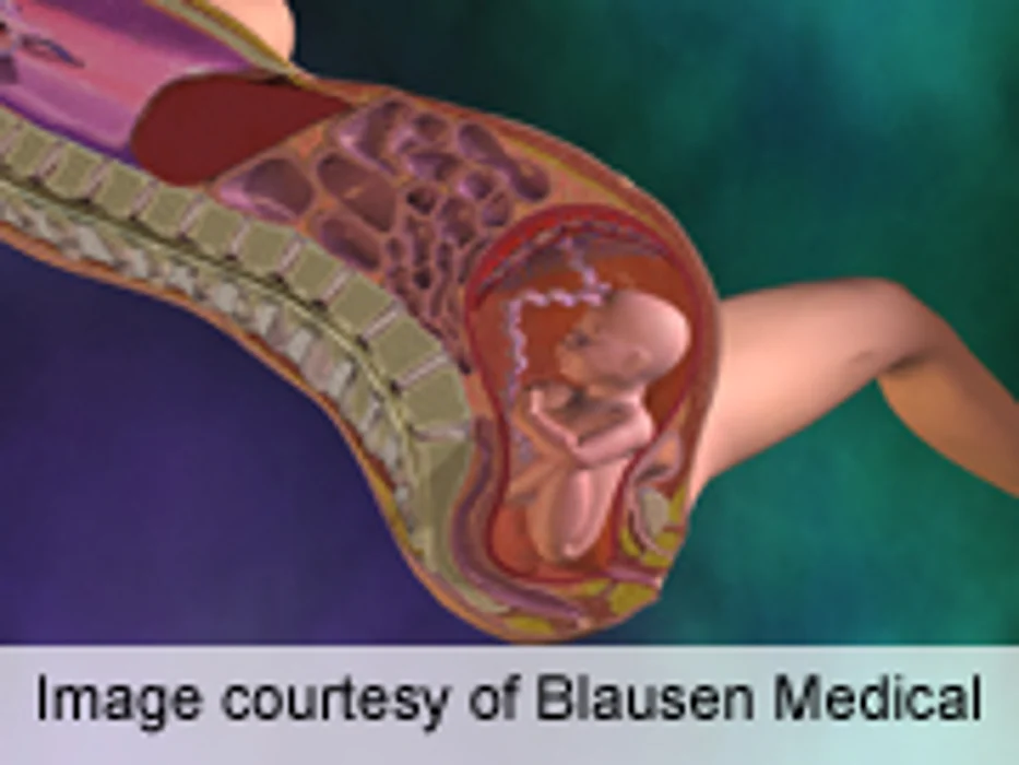 USPSTF Recommends GDM Screening After 24 Weeks