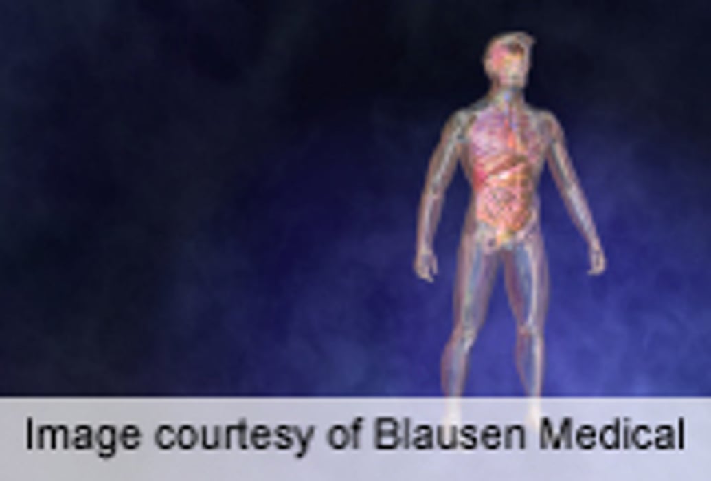 J-Shaped Link for BMI and Mortality in Incident T2DM